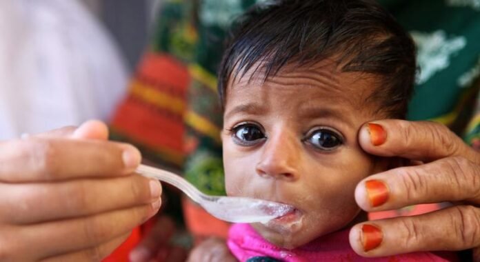 UNICEF: Appeal for $165 million to defeat 'silent killers' with special food

