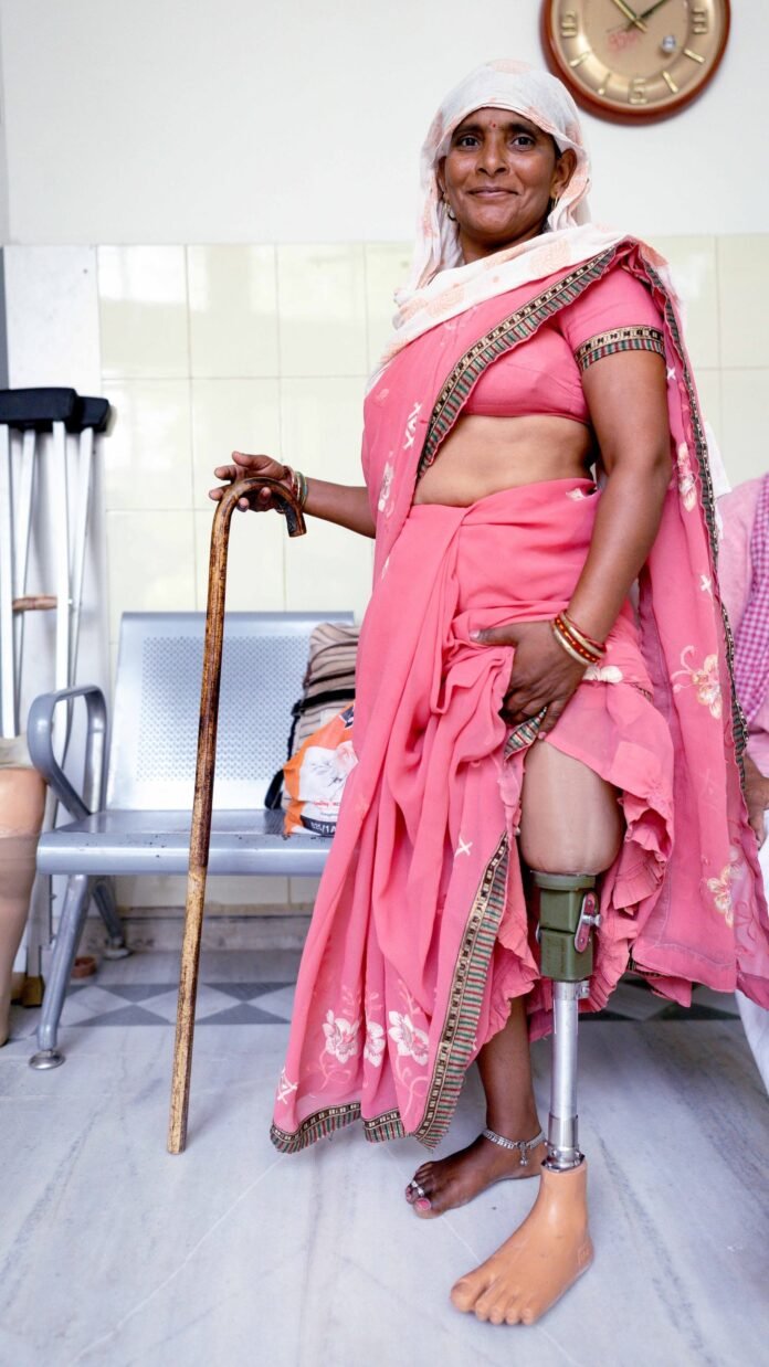 Jaipur legs of India - growing steps for the welfare of the disabled people

